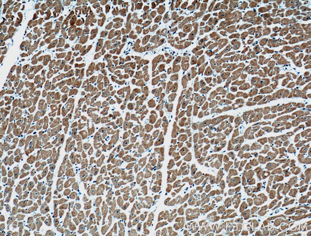 ARHGAP10 Polyclonal antibody