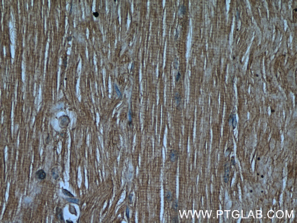 CaMKII gamma-Specific Polyclonal antibody