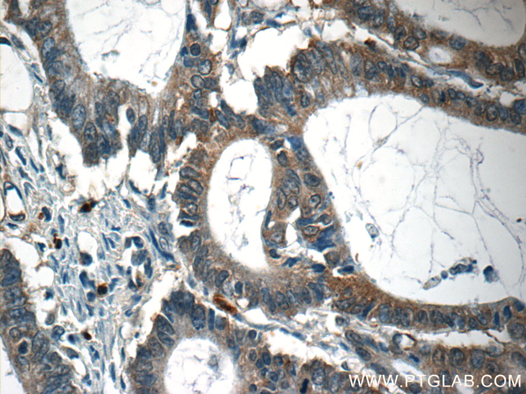 CAPZA1 Polyclonal antibody