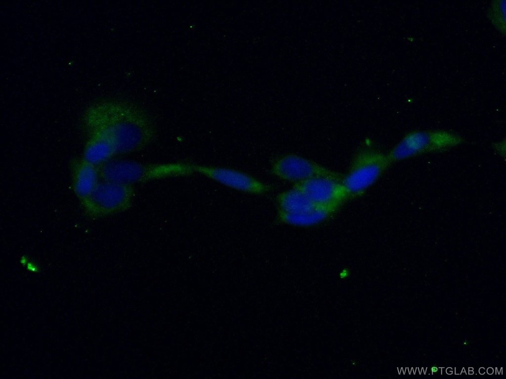 PPP3CB-specific Polyclonal antibody