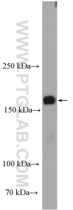 NAIP Polyclonal antibody