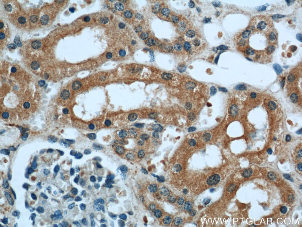 TULP4 Polyclonal antibody