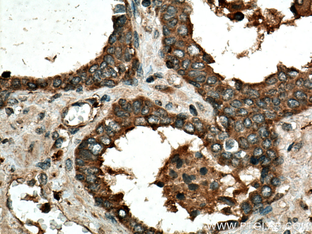 IDUA Polyclonal antibody