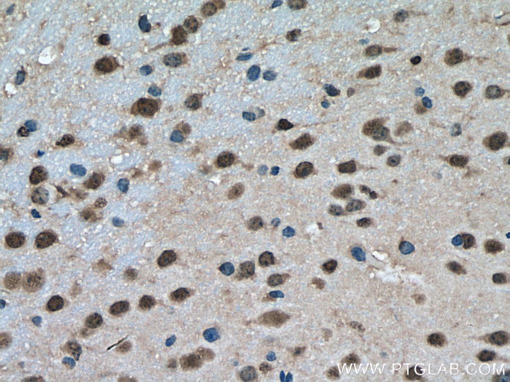 PTBP2 Polyclonal antibody