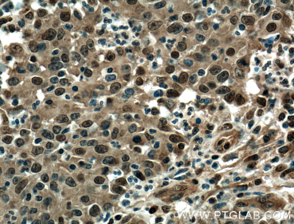 EWS Polyclonal antibody