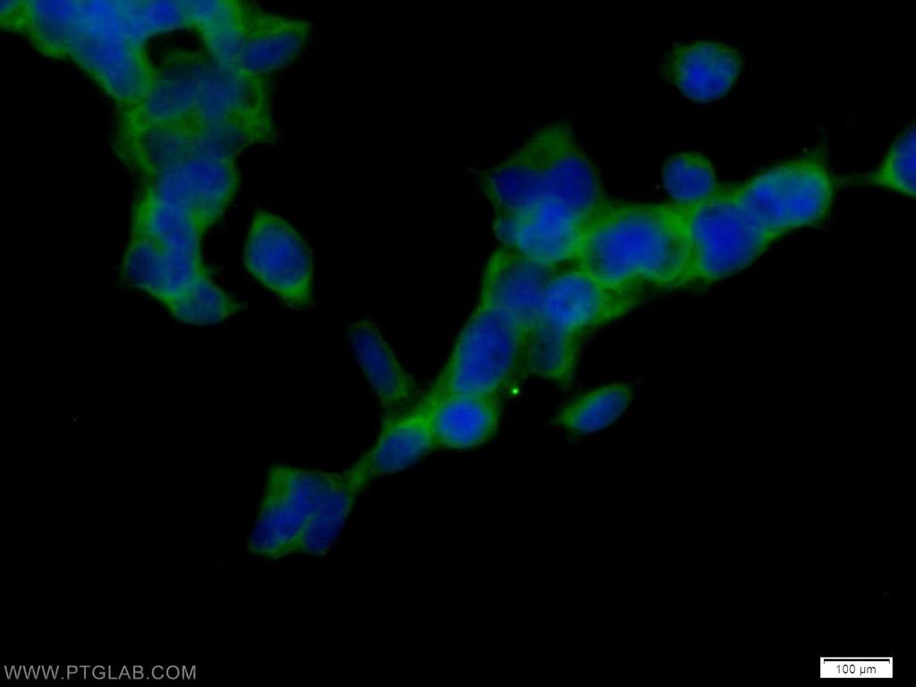 CaMKII beta-Specific Polyclonal antibody