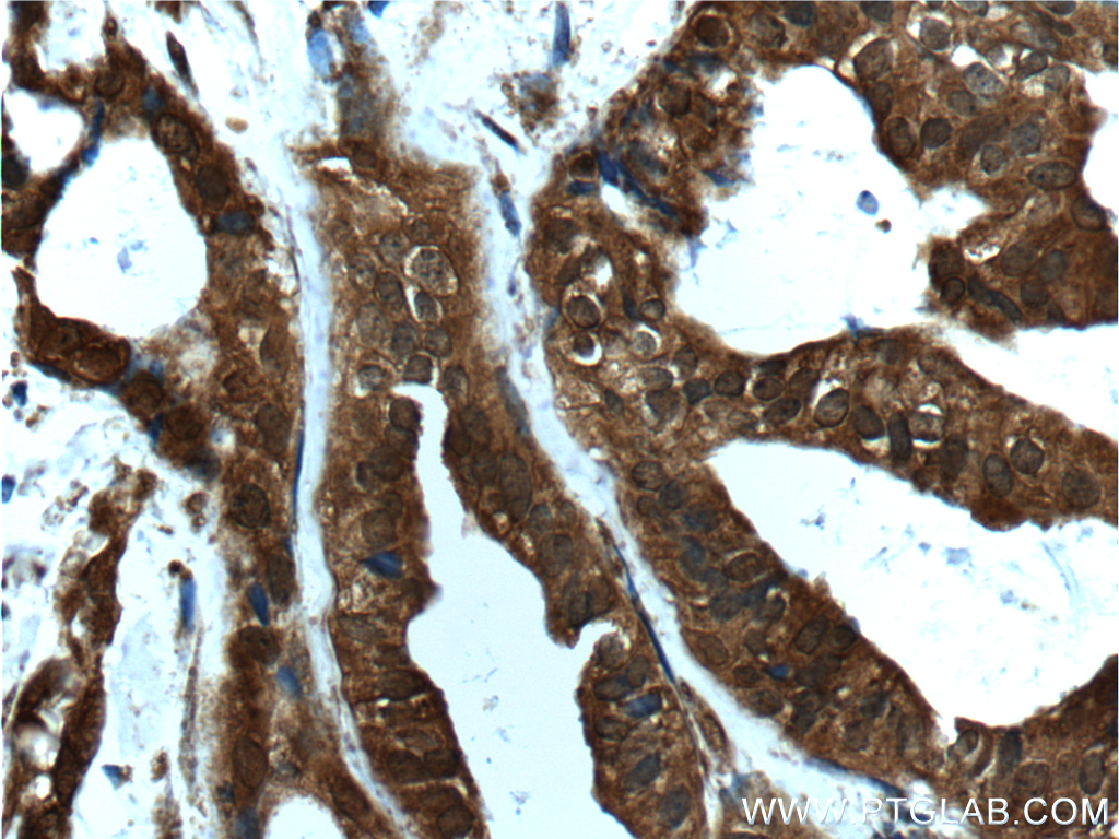AKT1 Polyclonal antibody