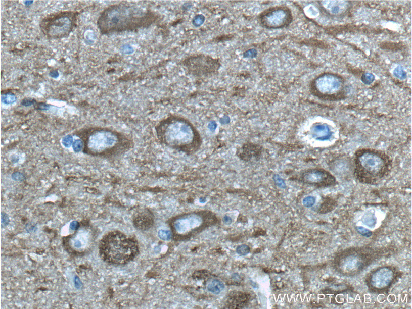 NSE/ENO2-specific Polyclonal antibody