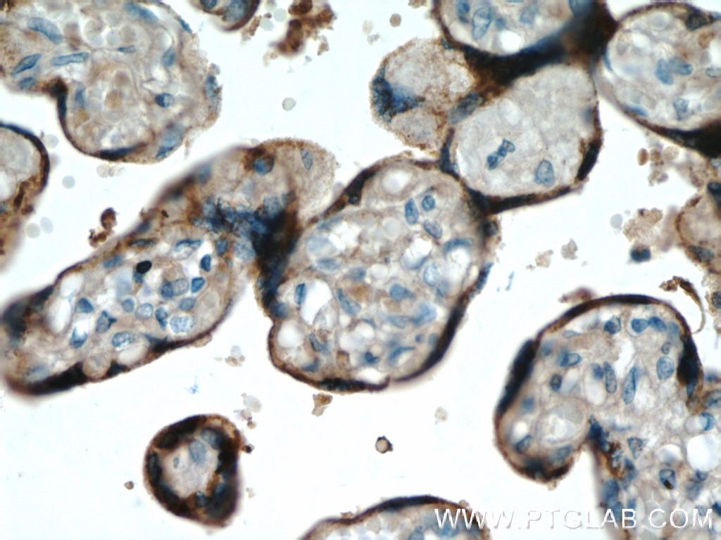 Placental lactogen Polyclonal antibody