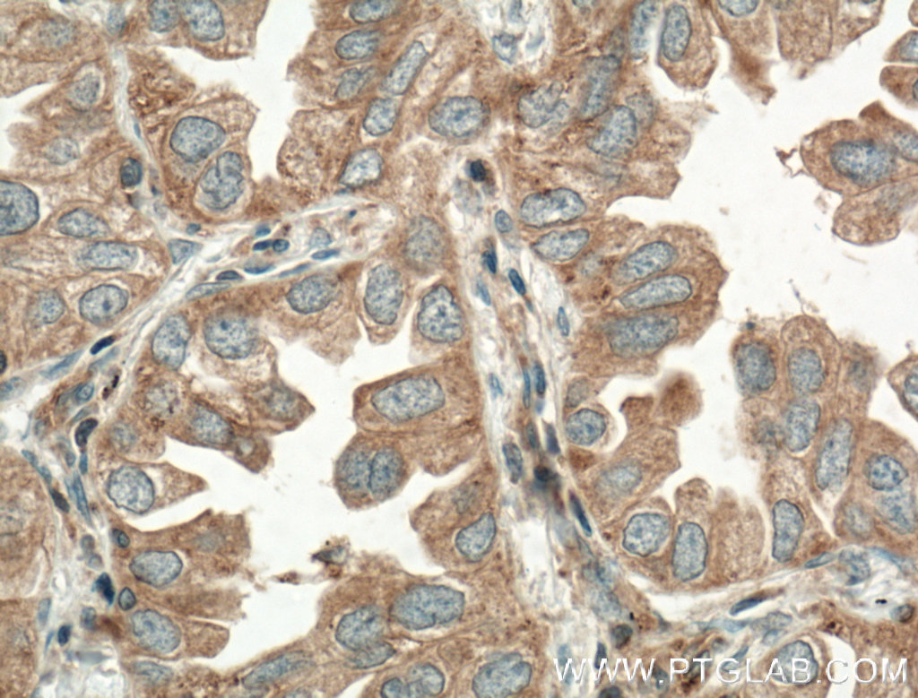 TPSD1 Polyclonal antibody