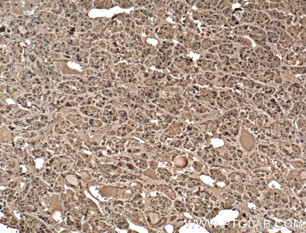 GH1 Polyclonal antibody
