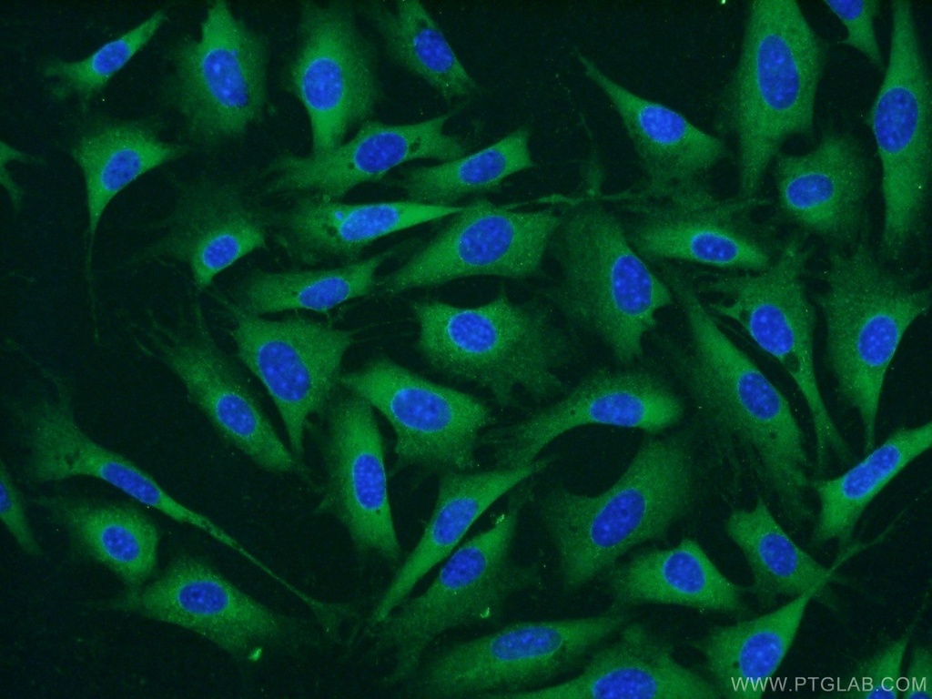 CARM1 Polyclonal antibody