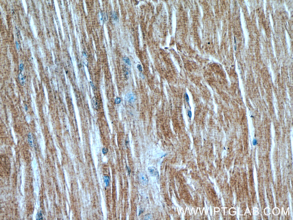 MAP4K4 Polyclonal antibody