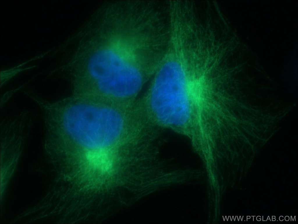 Alpha Parvin/Actopaxin Polyclonal antibody