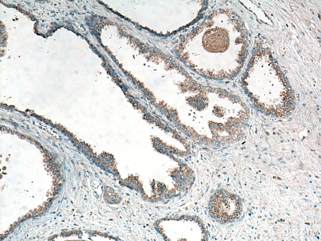 CTAGE5 Polyclonal antibody