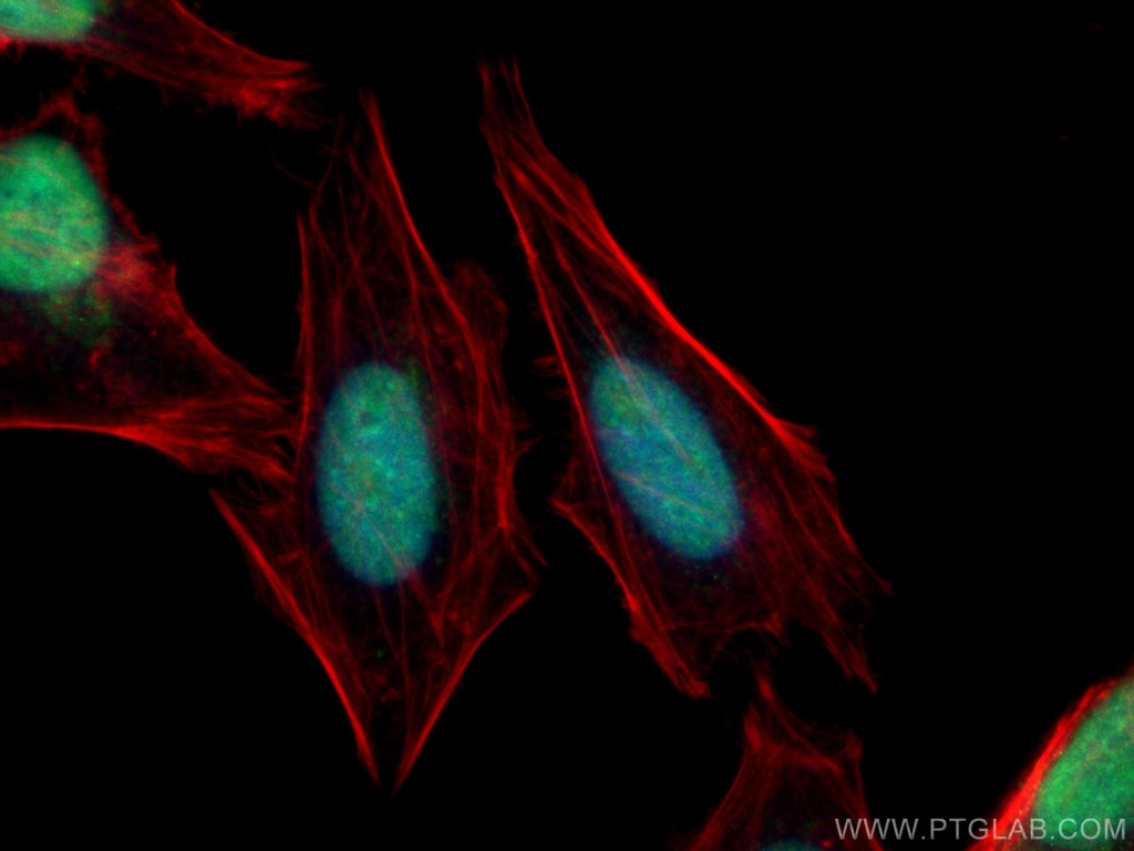FBXW7 Polyclonal antibody