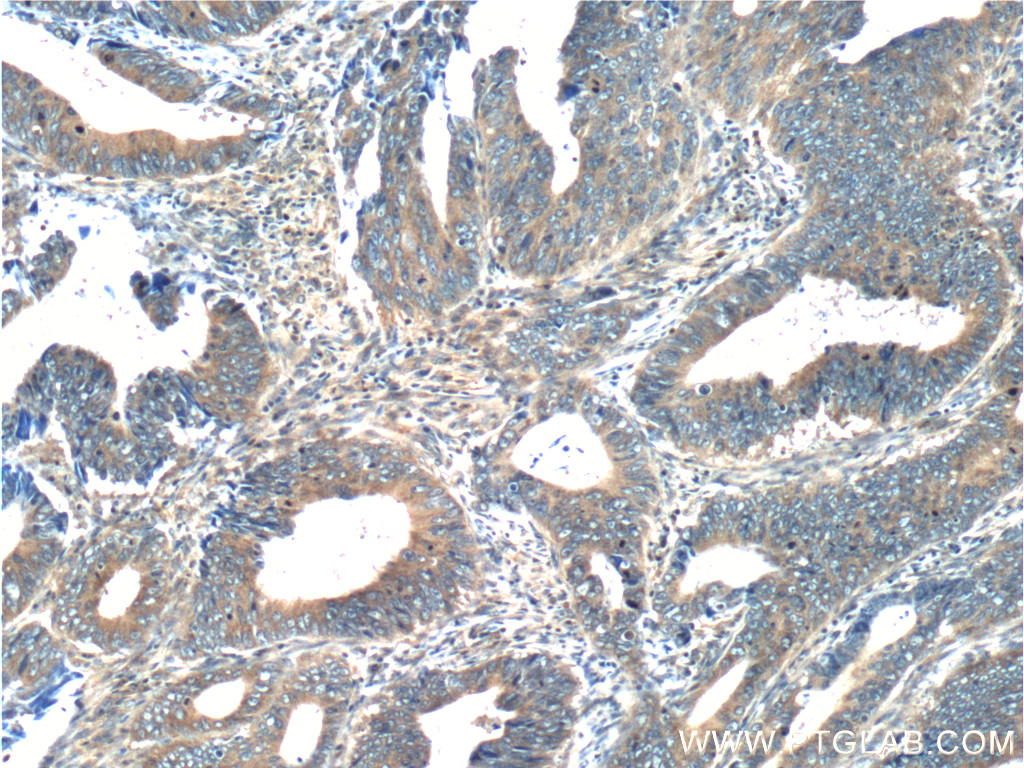 RAB8A Polyclonal antibody