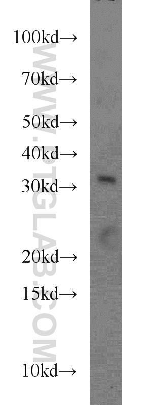 FOXE3 Polyclonal antibody