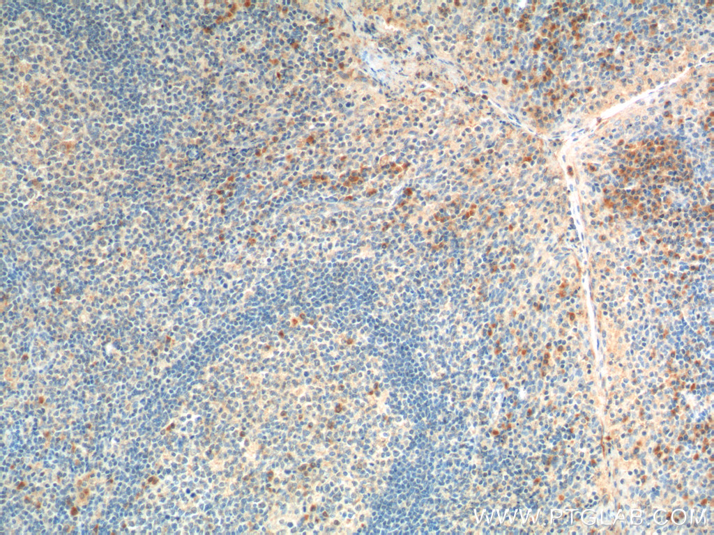 HTR1A Polyclonal antibody