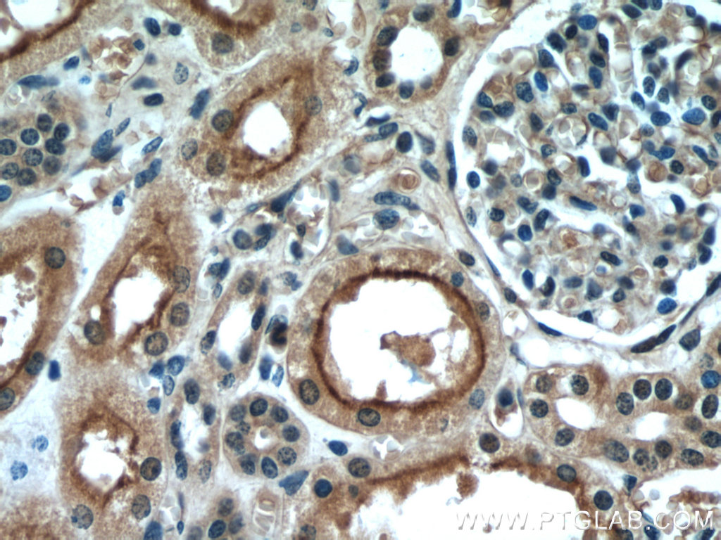 PDE2A Polyclonal antibody