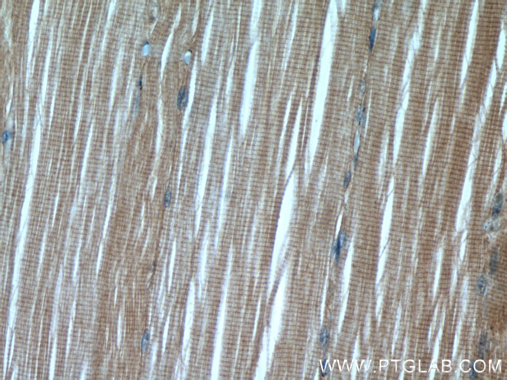PAMR1 Polyclonal antibody