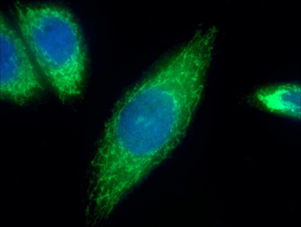 ATP6 Polyclonal antibody