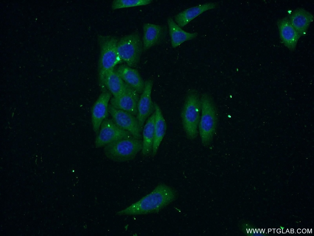 RNASE3 Polyclonal antibody