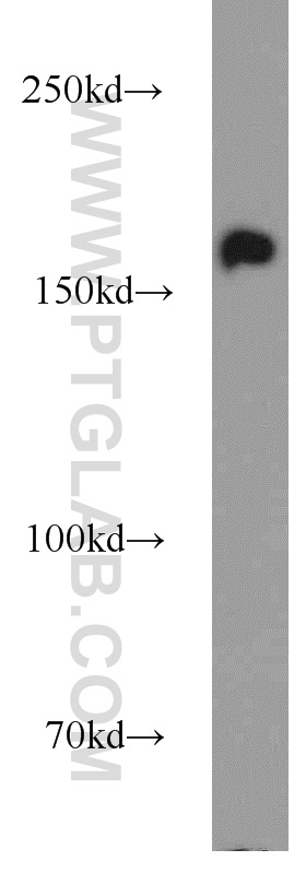 ANKRD11 Polyclonal antibody
