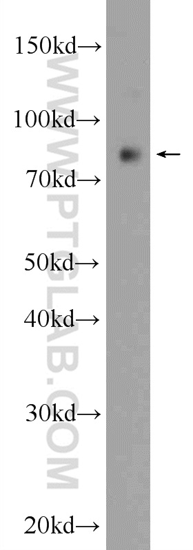 PPP1R3F Polyclonal antibody