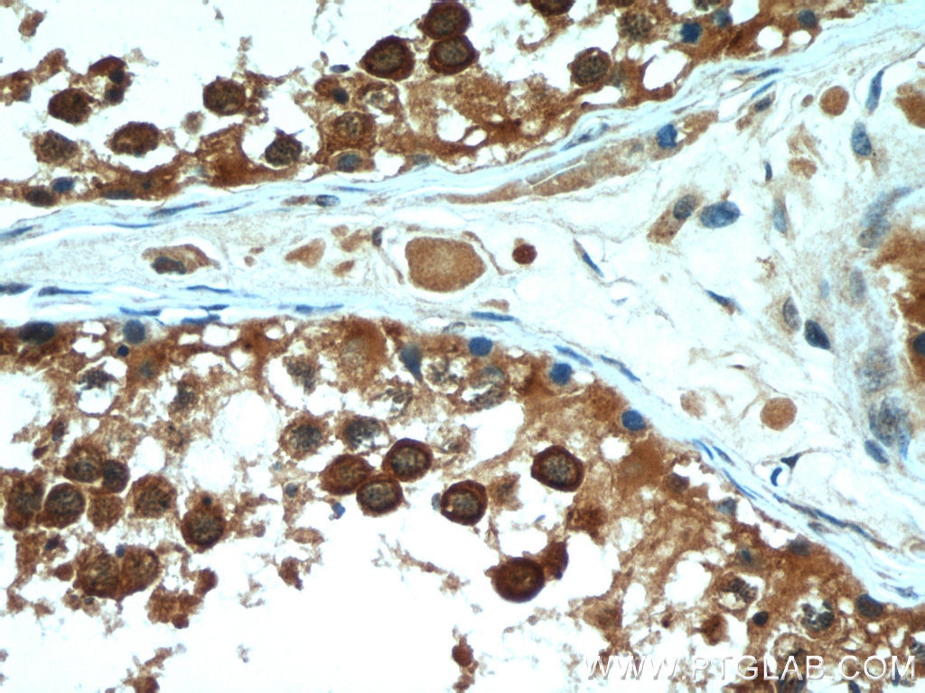 PGAP1 Polyclonal antibody