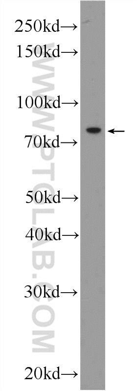 KLHL9 Polyclonal antibody