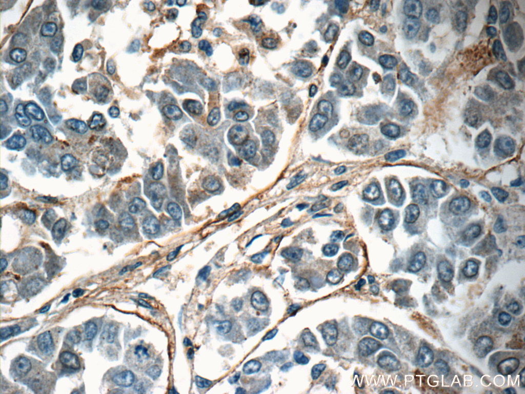 TMEM181 Polyclonal antibody