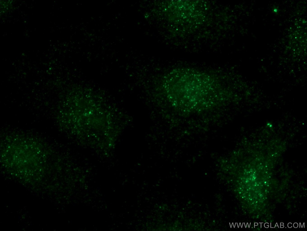 BCL11B Polyclonal antibody