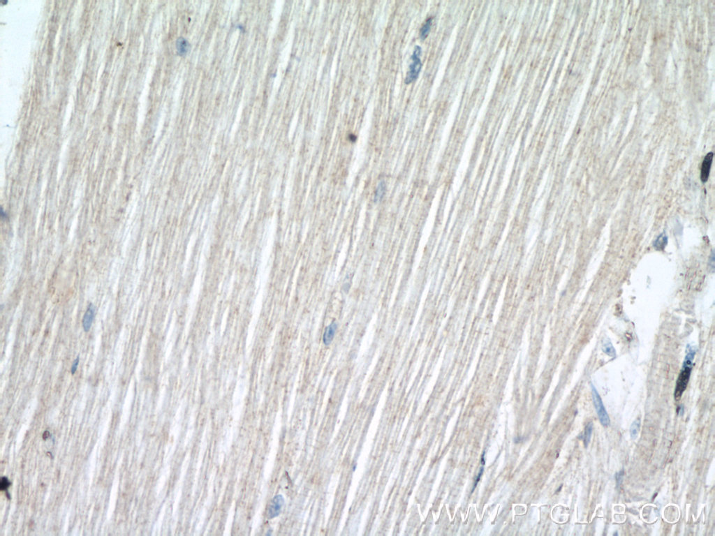 SCN4B Polyclonal antibody