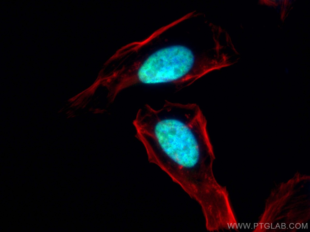 ESR2 Beta 3 Polyclonal antibody