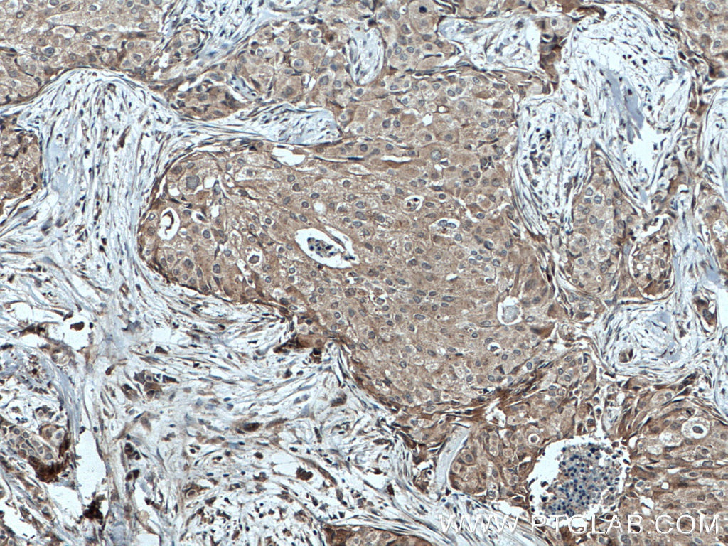 TPM2 Polyclonal antibody