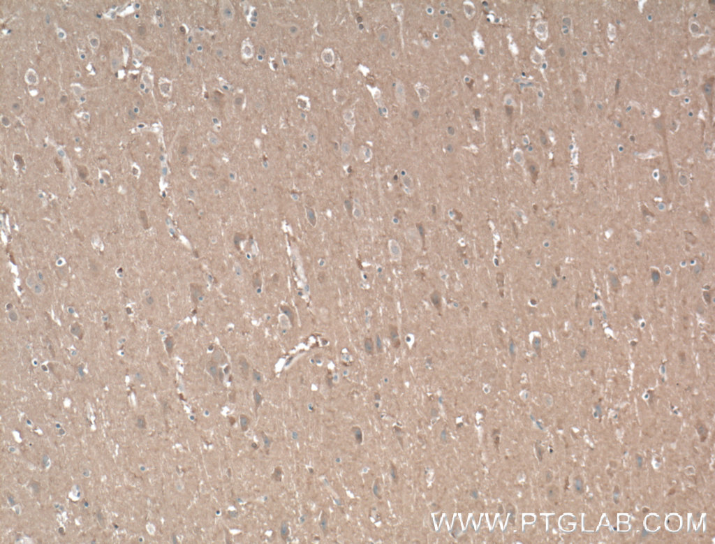 AHSA2 Polyclonal antibody