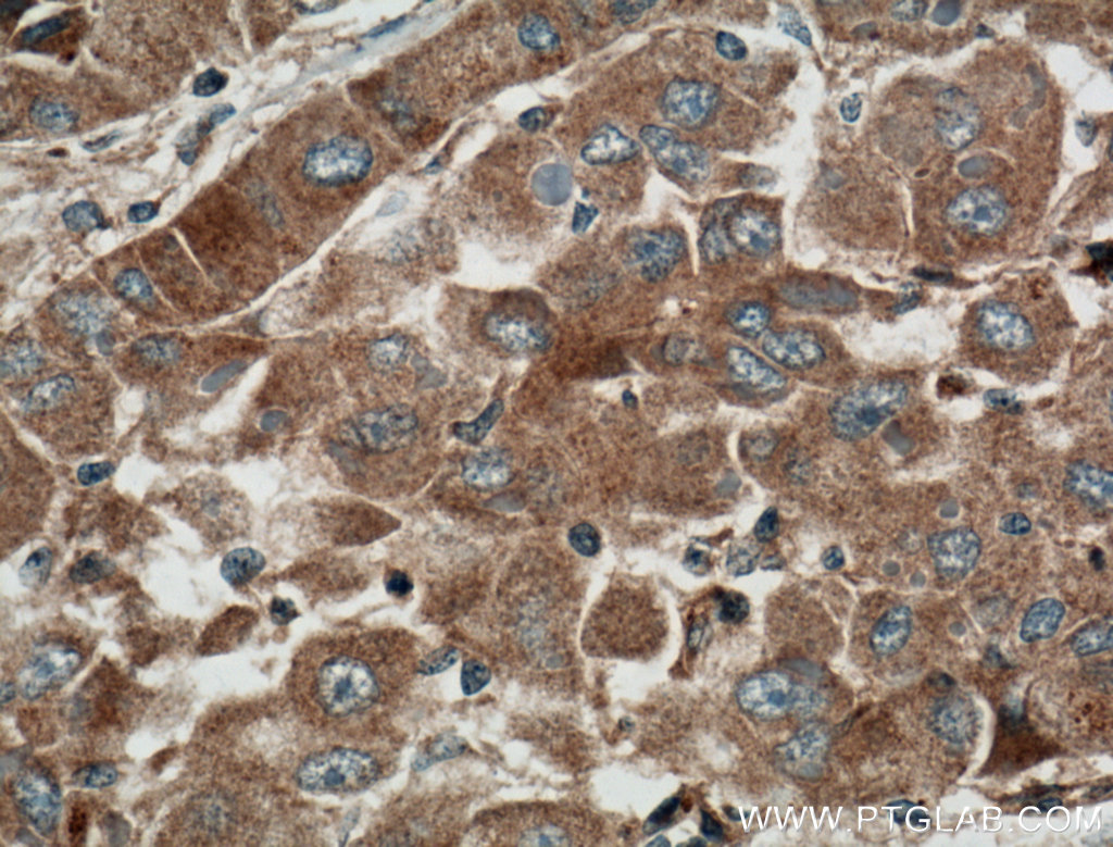 Cyp2c7 Polyclonal antibody