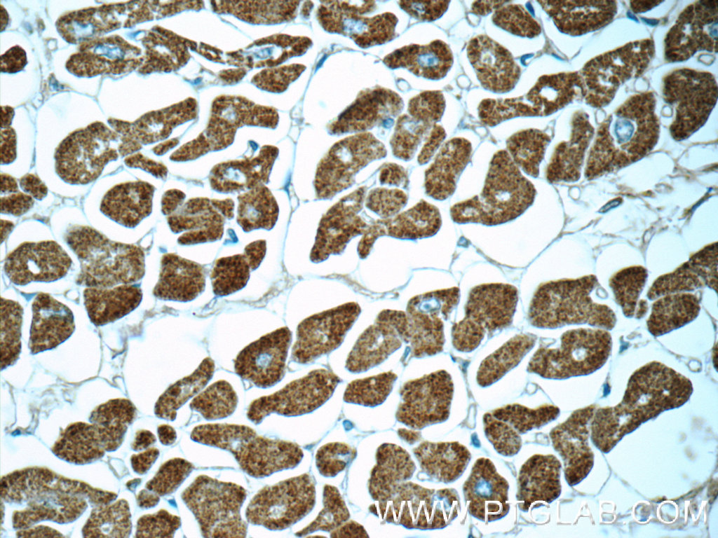 Myosin Light Chain 2/MLC-2V Polyclonal antibody