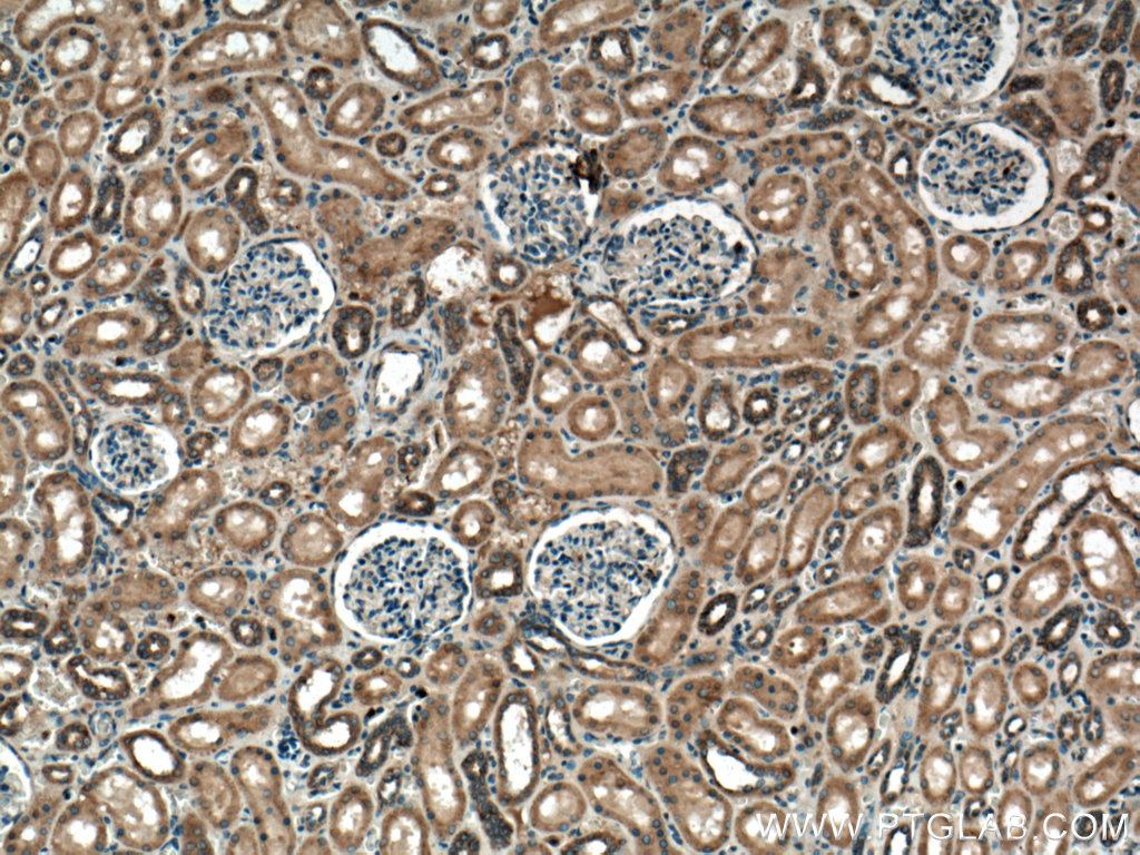 RAB7A Polyclonal antibody