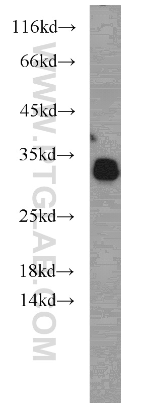 NPAS3 Polyclonal antibody