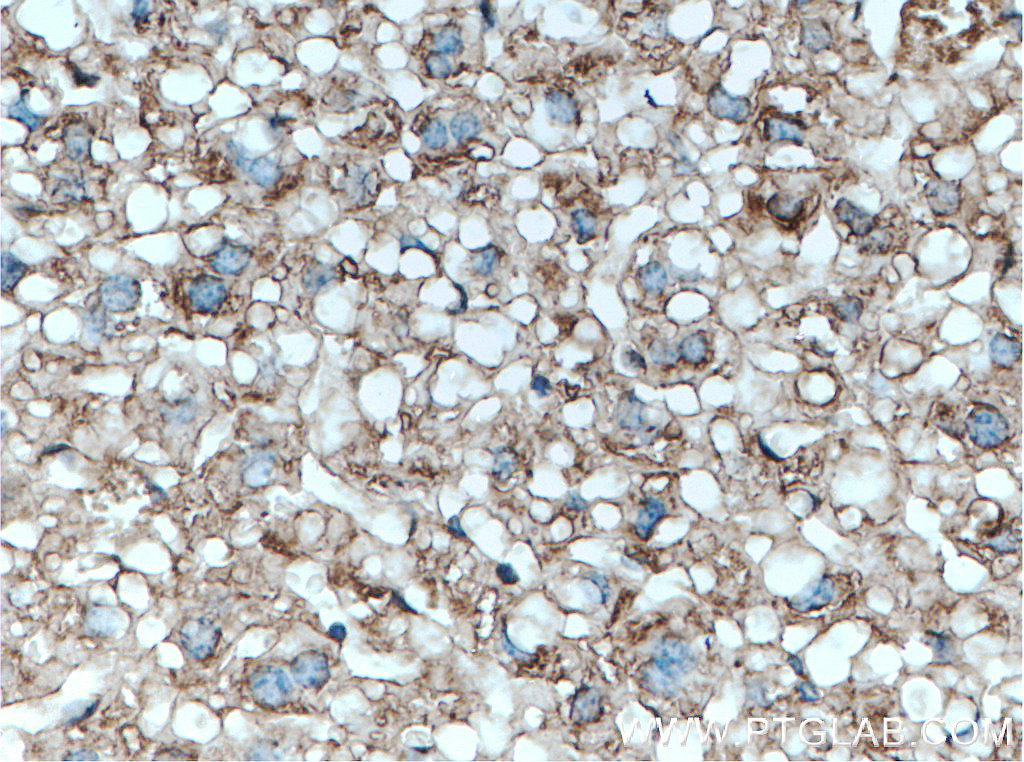 Serpina3k Polyclonal antibody