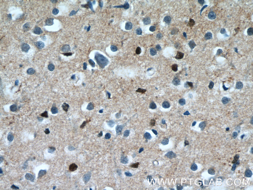 NKX1-2 Polyclonal antibody