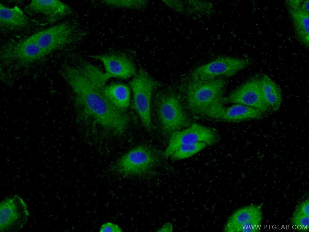 MUC8 Polyclonal antibody