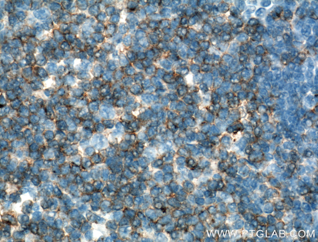 CD2 Monoclonal antibody