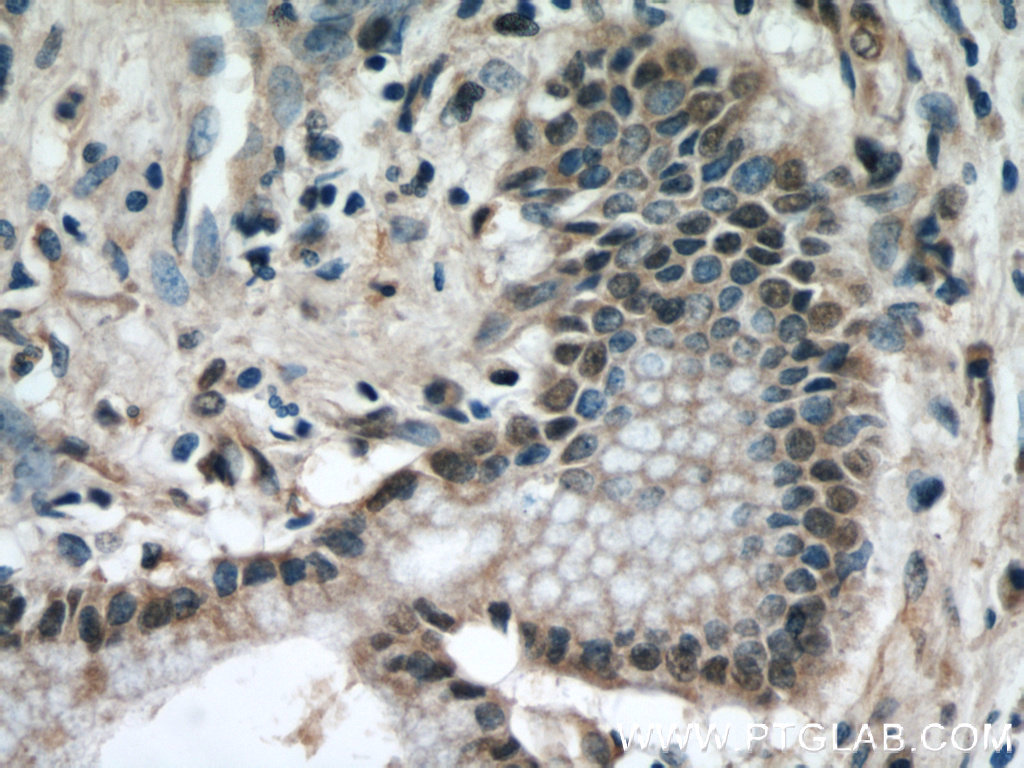 KEAP1 Monoclonal antibody