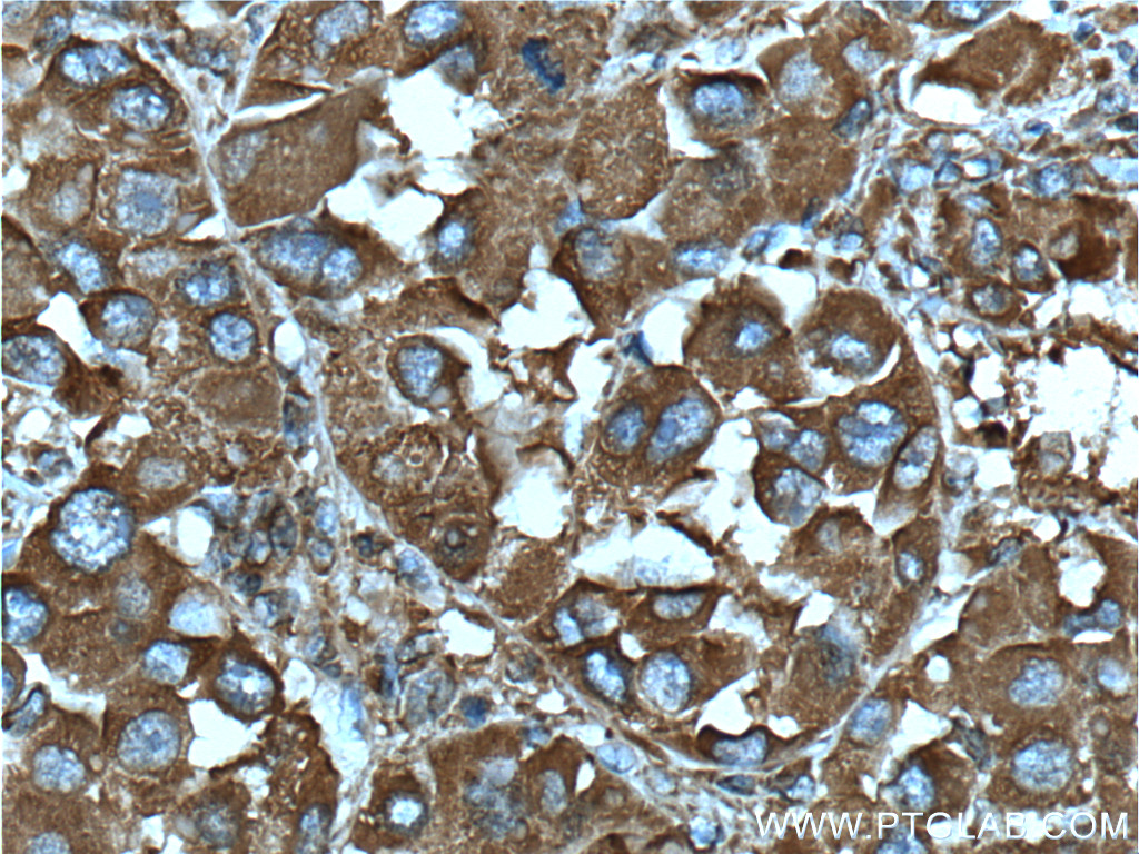 DSE Monoclonal antibody