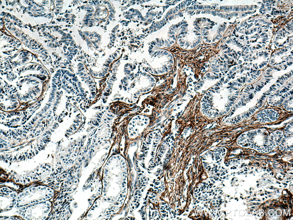 EMILIN1 Monoclonal antibody