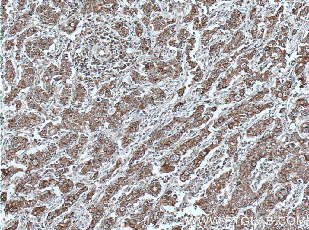 STOML2 Monoclonal antibody