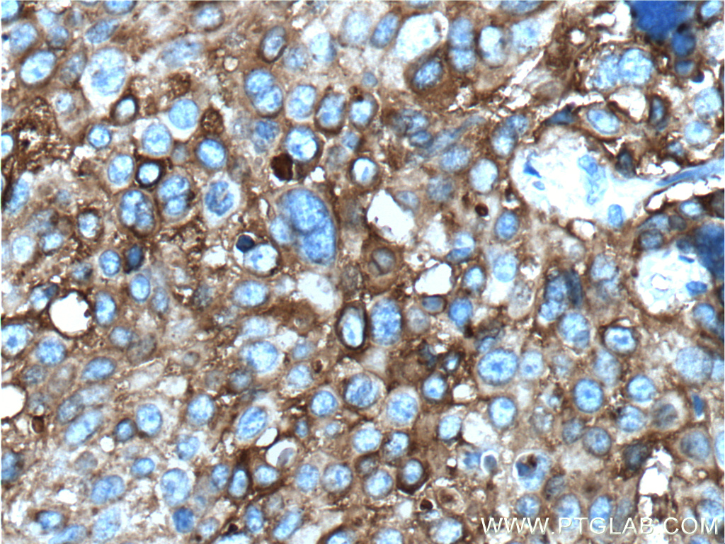 MAGEA3 Monoclonal antibody